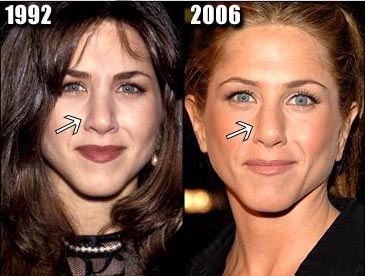 jenny avant et apr&egrave;s