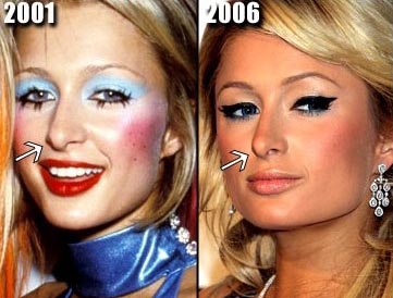 paris avant et ar&egrave;s