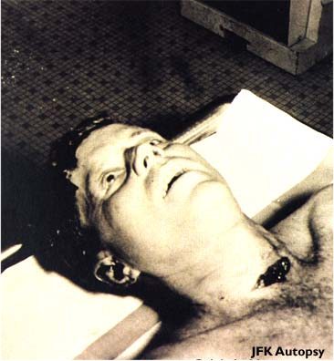 le cadavre de kennedy